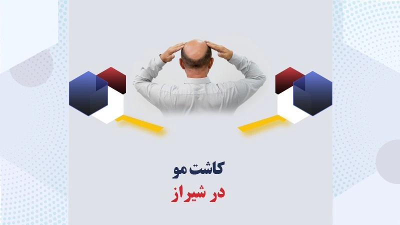 کاشت-مو-شیراز
